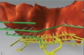 Article Thumbnail Image